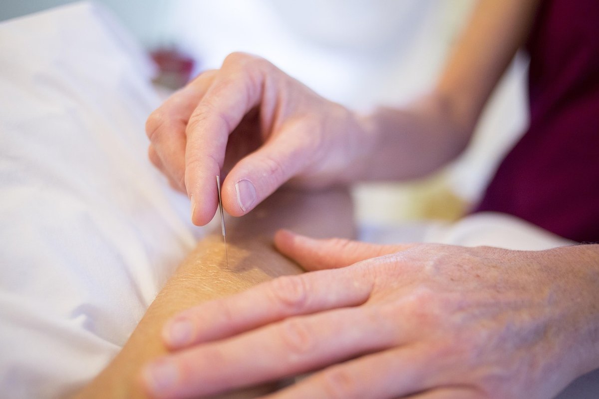 Practitioner's hands inserting a fine acupuncture needle into a patient's forearm